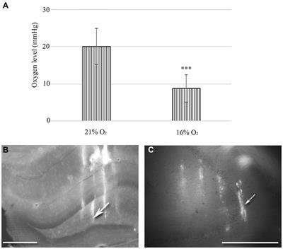 Mild hypoxia-induced structural and functional changes of the hippocampal network